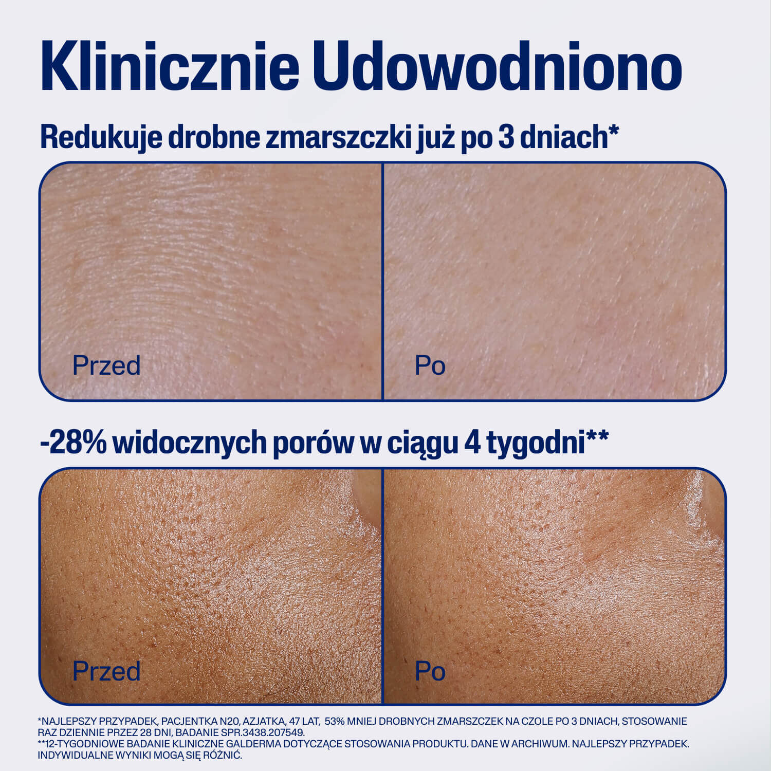 Cetaphil Advanced Defence Serum &ndash; Zaawansowane Serum Ochronne