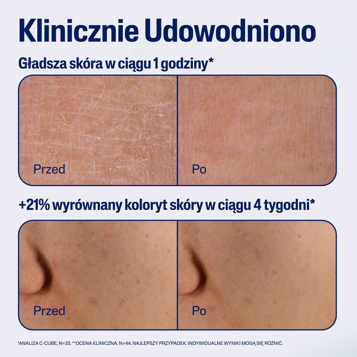 Cetaphil Repair & Renew Serum &ndash; Odbudowujące Serum Naprawcze